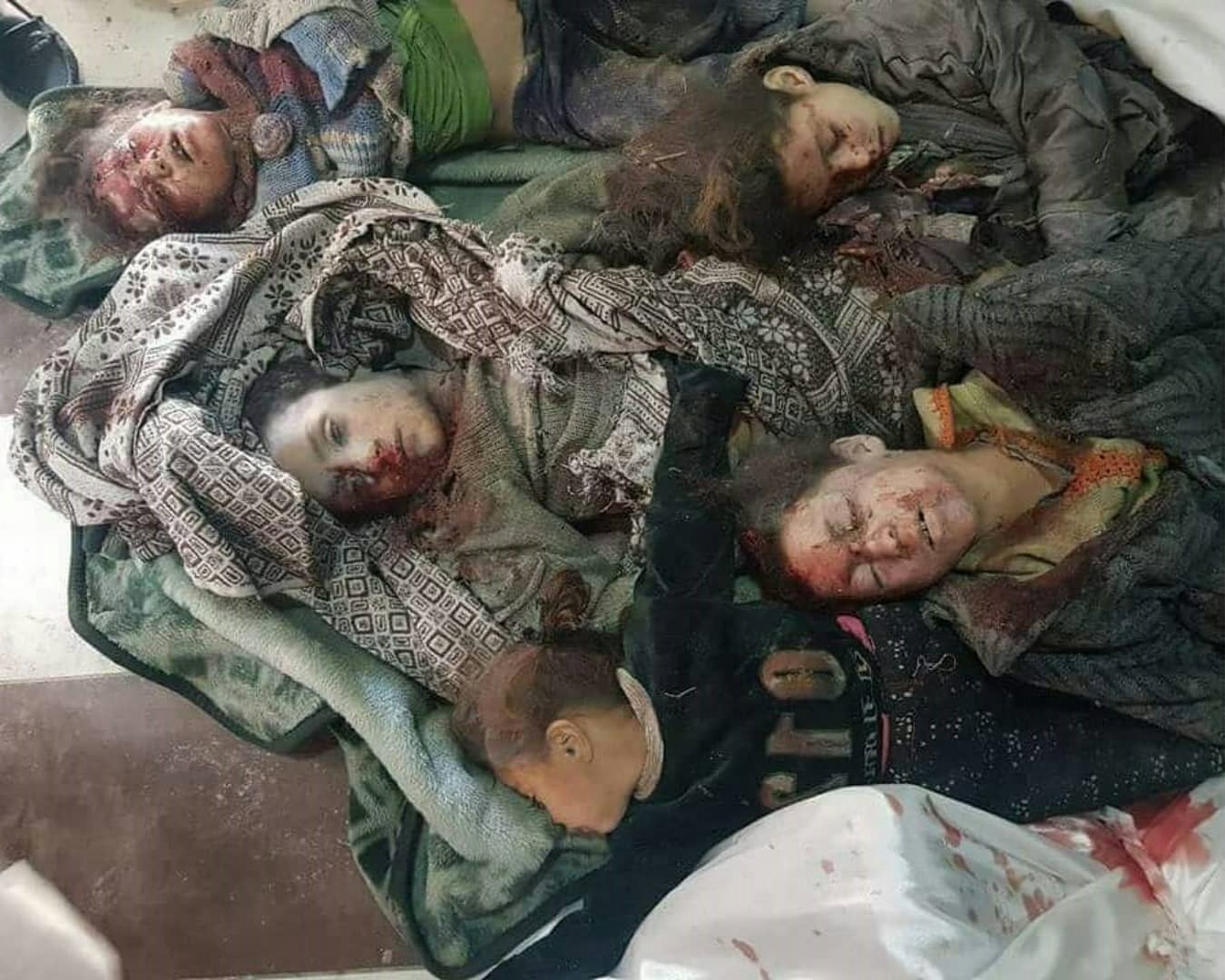 Sharqiy Gʻuta bolalari qirgʻin qilinmoqda! Ularning hayotini kim himoya qiladi?